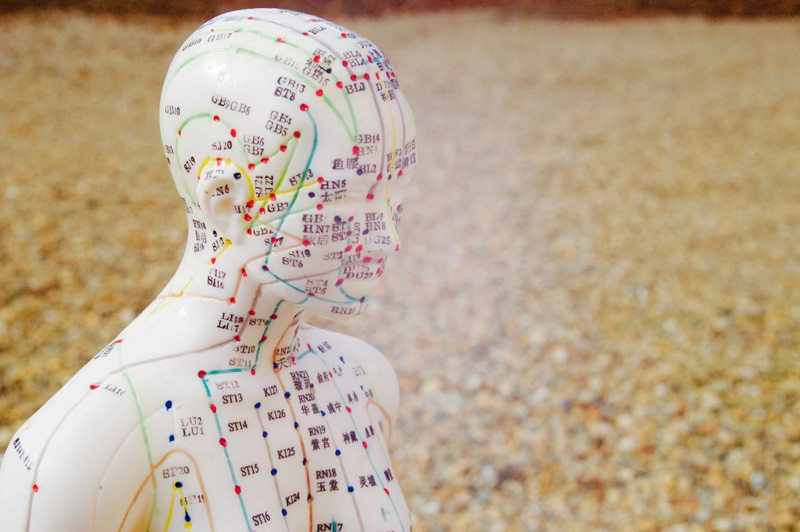 Acupuncture Jodie Treloar_D.jpg